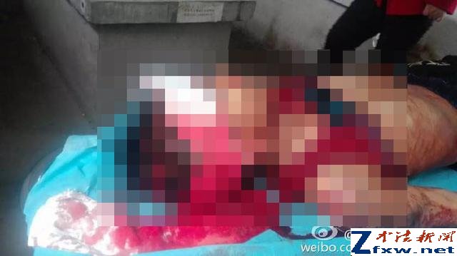 山东一女教师棒击4名孩子致1死3伤 已被刑拘