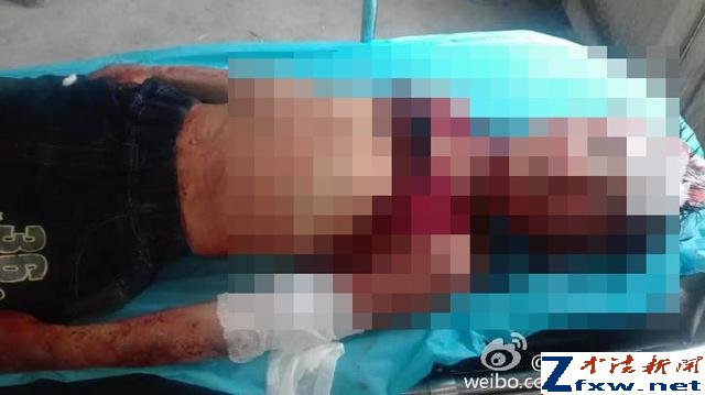 山东一女教师棒击4名孩子致1死3伤 已被刑拘