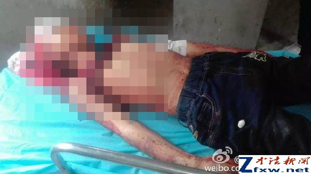 山东一女教师棒击4名孩子致1死3伤 已被刑拘